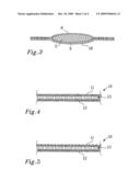 ABSORBENT ARTICLE COMPRISING AN ELASTIC LAMINATE MATERIAL diagram and image