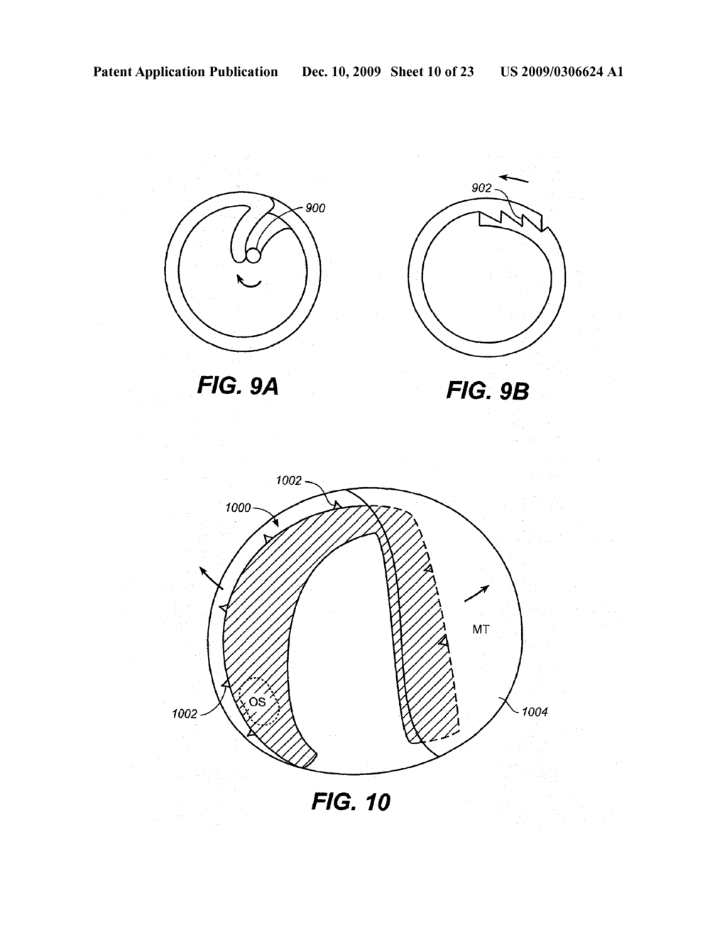 DEVICES AND METHODS FOR DELIVERING ACTIVE AGENTS TO THE OSTEOMEATAL COMPLEX - diagram, schematic, and image 11