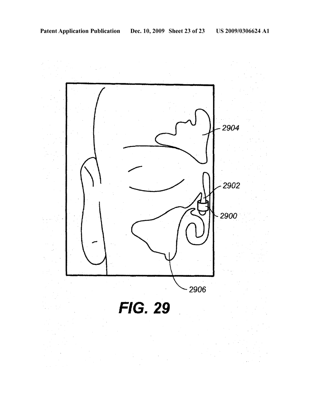 DEVICES AND METHODS FOR DELIVERING ACTIVE AGENTS TO THE OSTEOMEATAL COMPLEX - diagram, schematic, and image 24