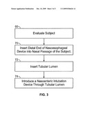 DEVICES AND METHODS FOR NASOENTERIC INTUBATION diagram and image