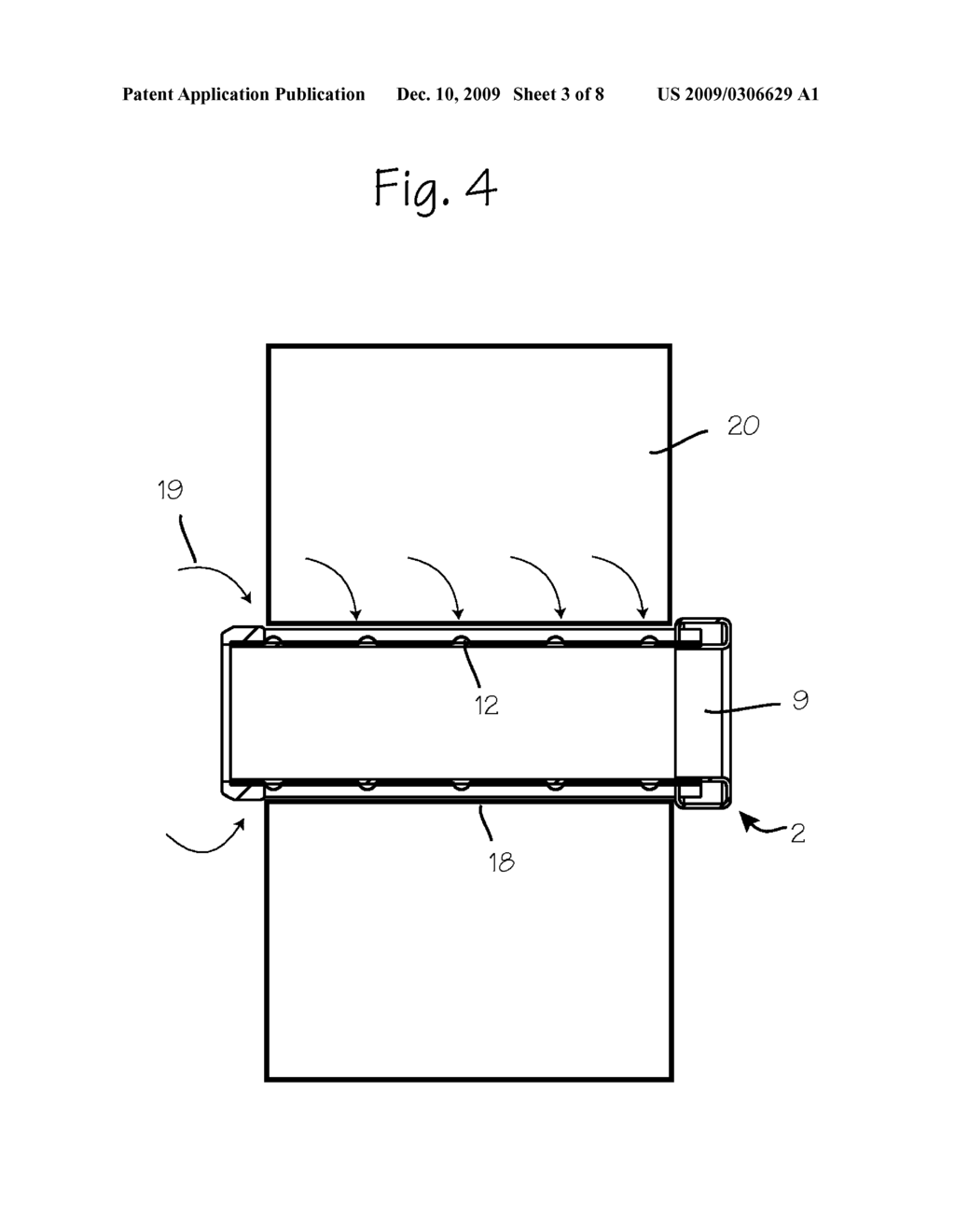 Extravasation Minimization Device - diagram, schematic, and image 04