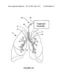 SYSTEMS, ASSEMBLIES, AND METHODS FOR TREATING A BRONCHIAL TREE diagram and image