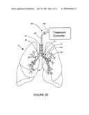 SYSTEMS, ASSEMBLIES, AND METHODS FOR TREATING A BRONCHIAL TREE diagram and image