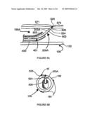 SYSTEMS, ASSEMBLIES, AND METHODS FOR TREATING A BRONCHIAL TREE diagram and image