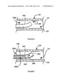 SYSTEMS, ASSEMBLIES, AND METHODS FOR TREATING A BRONCHIAL TREE diagram and image