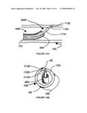 SYSTEMS, ASSEMBLIES, AND METHODS FOR TREATING A BRONCHIAL TREE diagram and image