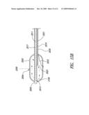 SYSTEMS, ASSEMBLIES, AND METHODS FOR TREATING A BRONCHIAL TREE diagram and image