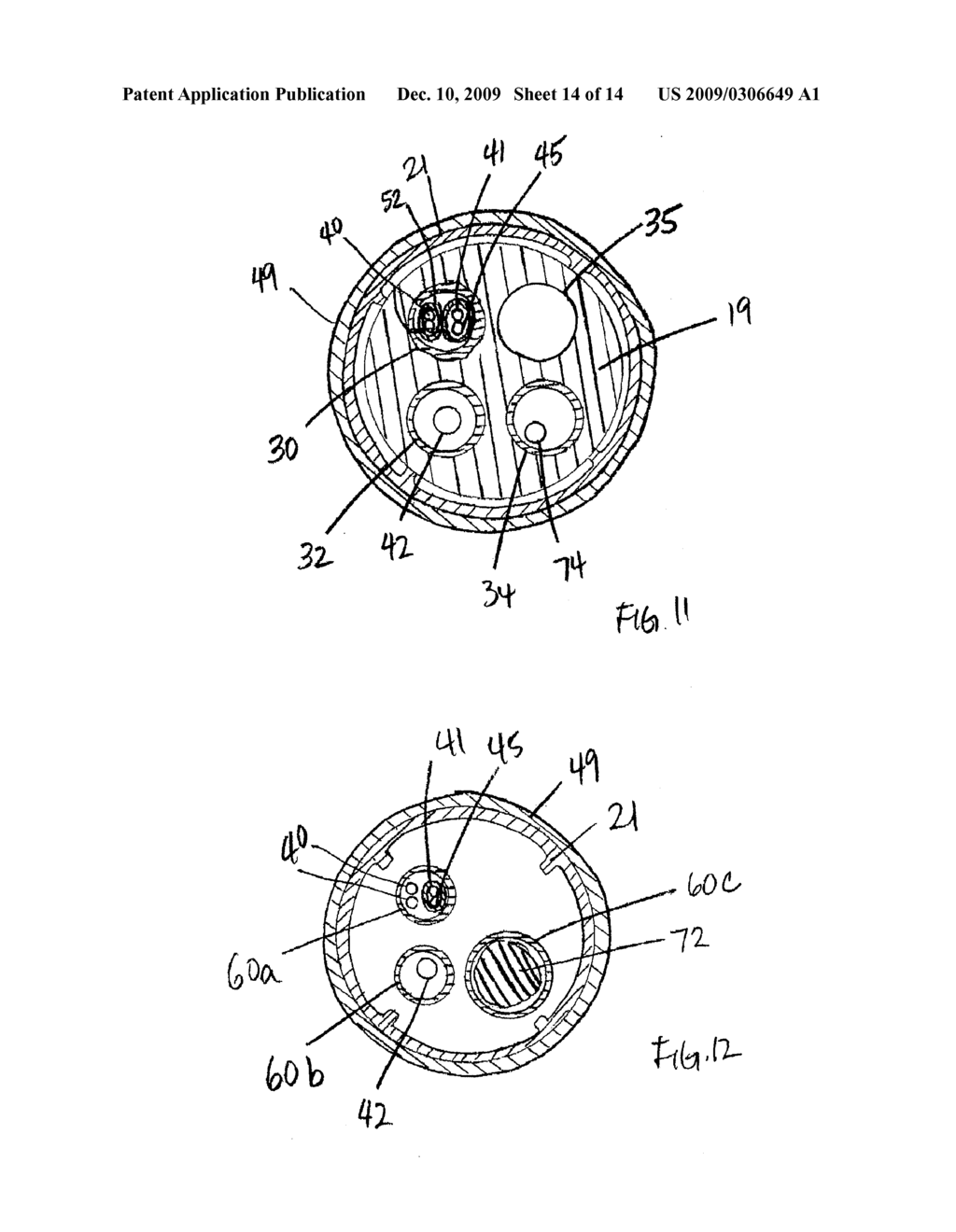 IRRIGATED CATHETER WITH IMPROVED IRRIGATION FLOW - diagram, schematic, and image 15