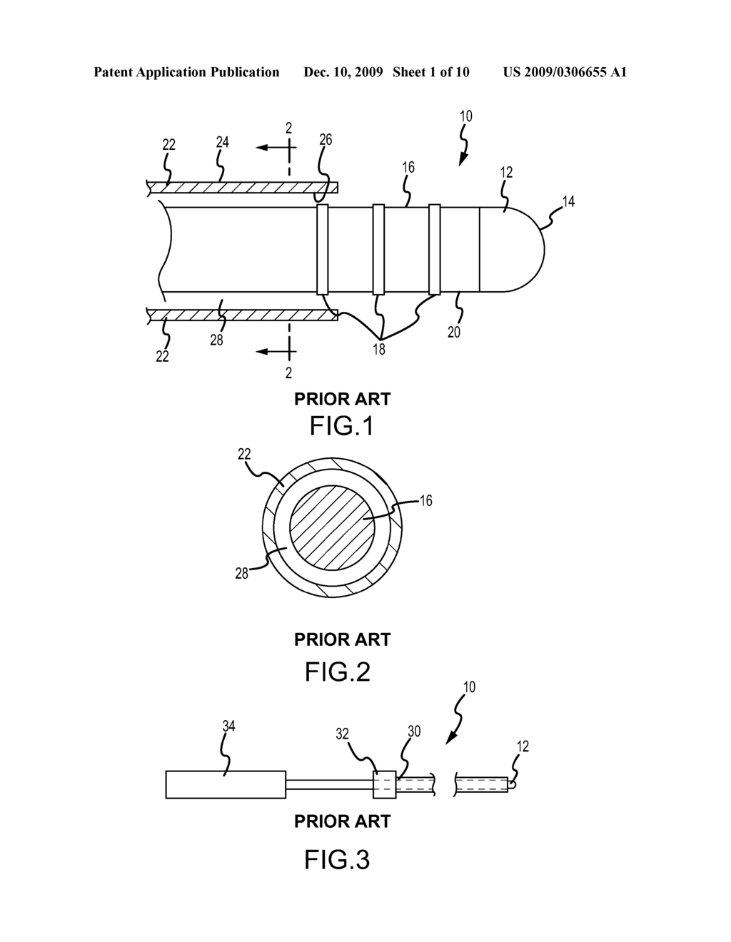 CATHETER ASSEMBLY WITH FRONT-LOADED TIP AND MULTI-CONTACT CONNECTOR - diagram, schematic, and image 02