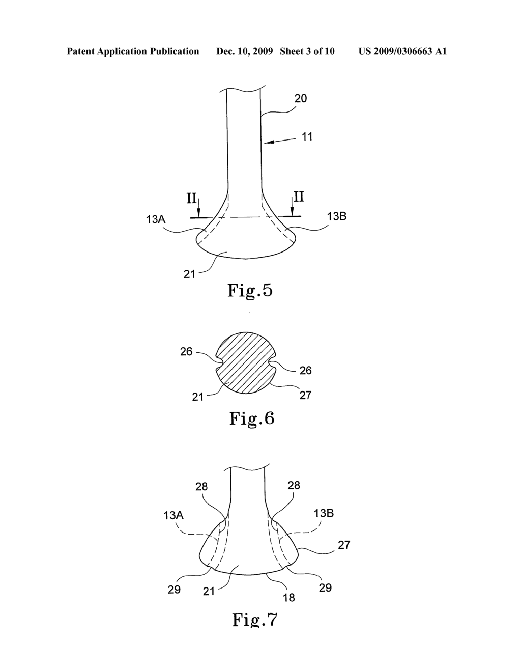 Bone Fixation Device - diagram, schematic, and image 04