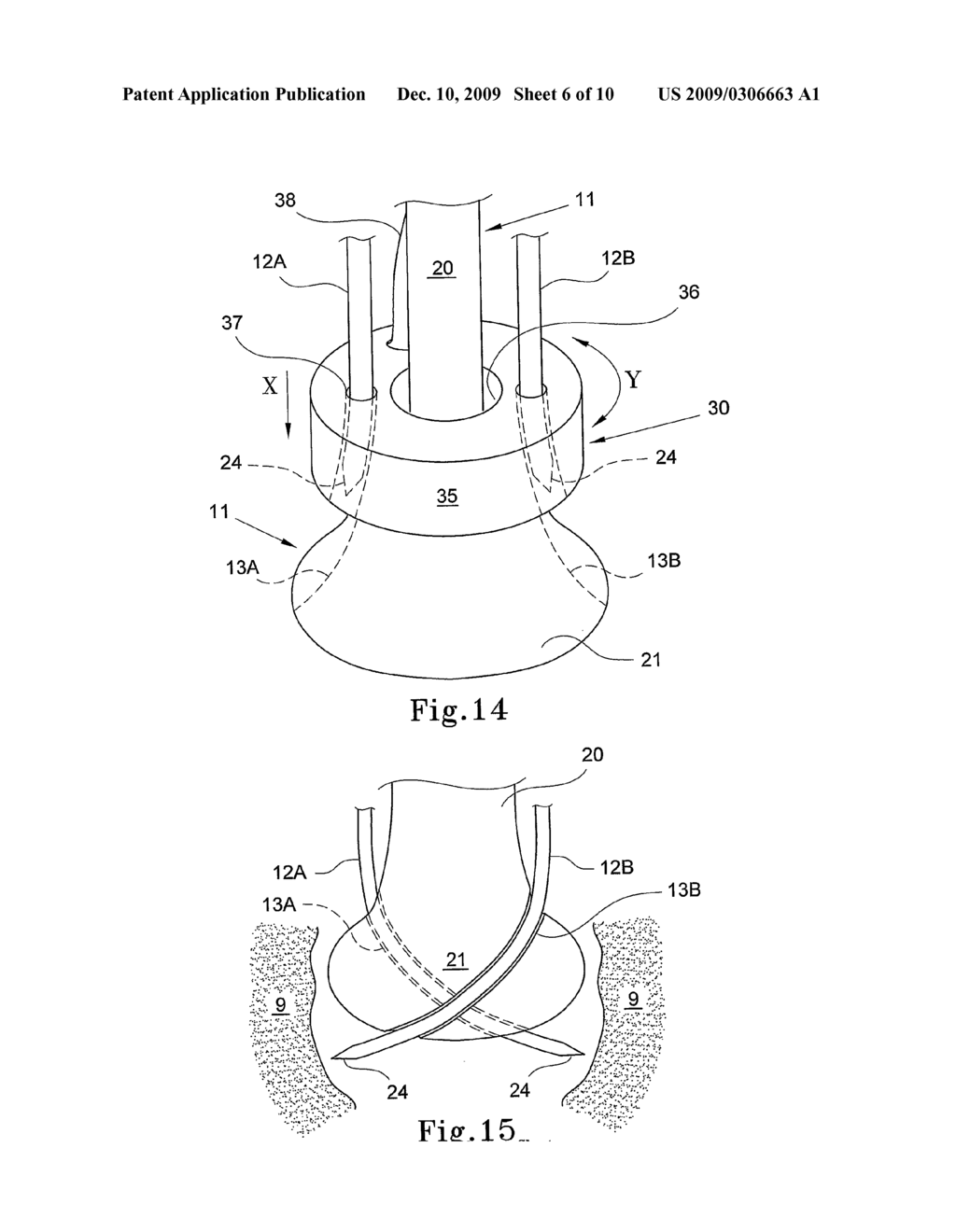 Bone Fixation Device - diagram, schematic, and image 07