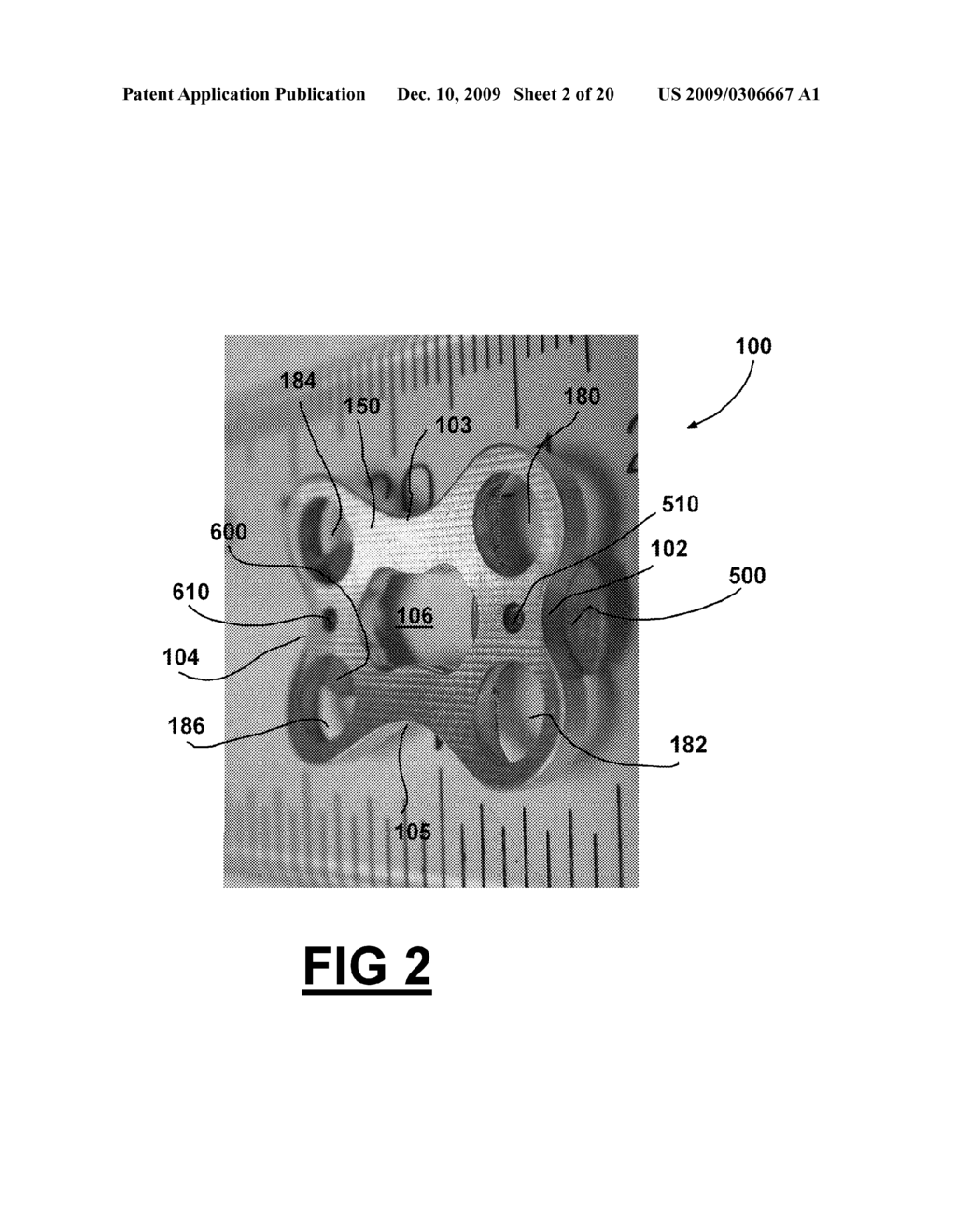 METHOD AND APPARATUS FOR CERVICAL FUSION - diagram, schematic, and image 03