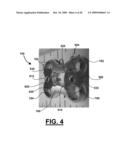 METHOD AND APPARATUS FOR CERVICAL FUSION diagram and image