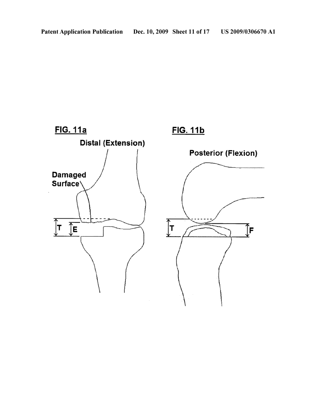 Unicondylar Knee Instrument System - diagram, schematic, and image 12