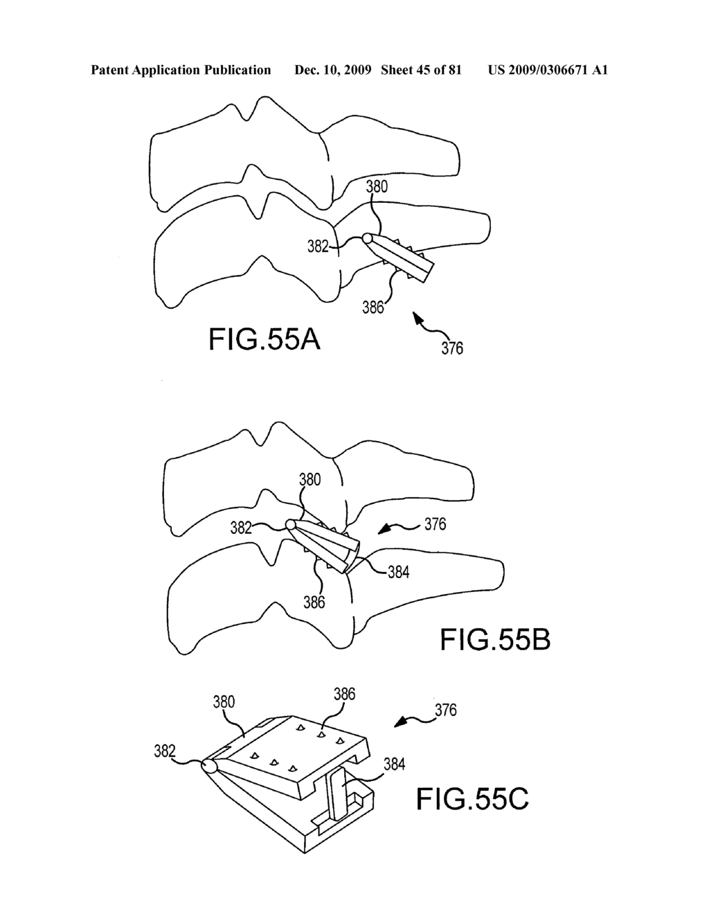 Facet joint implants and delivery tools - diagram, schematic, and image 46