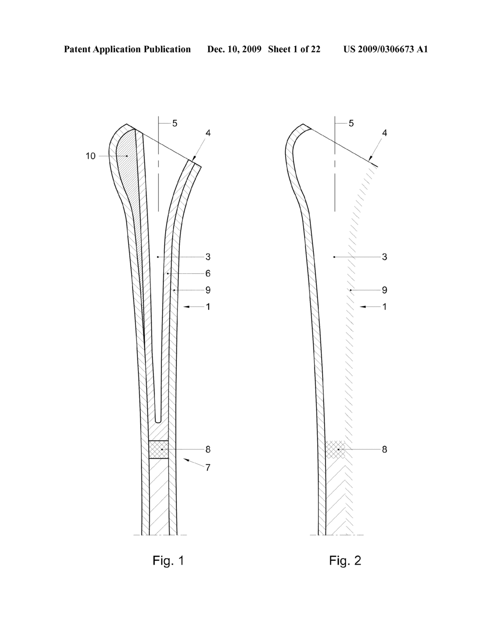 KIT AND METHOD FOR FIXATING A PROSTHESIS OR PART THEREOF AND/OR FILLING OSSEOUS DEFECTS - diagram, schematic, and image 02