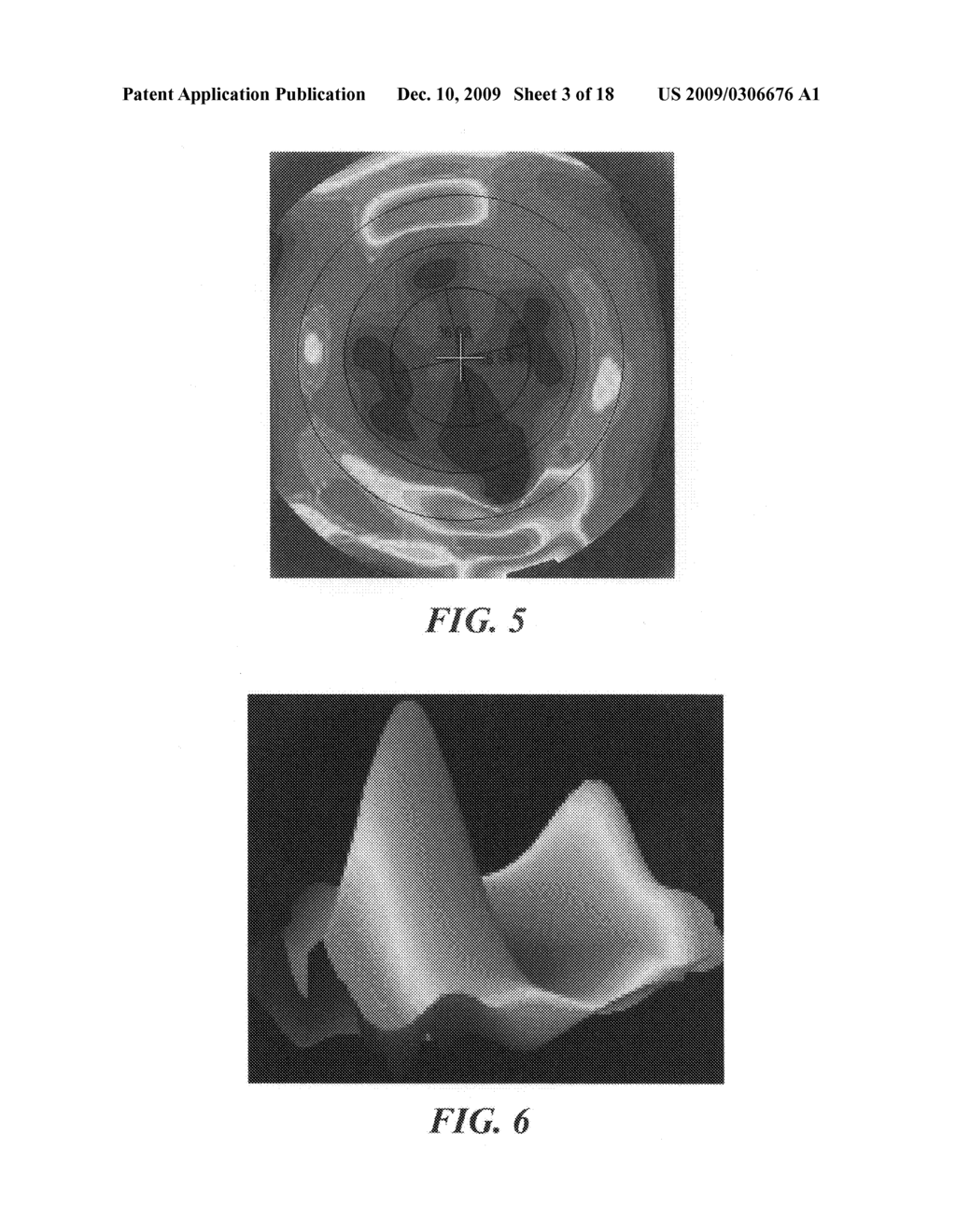 Methods and compositions for articular repair - diagram, schematic, and image 04