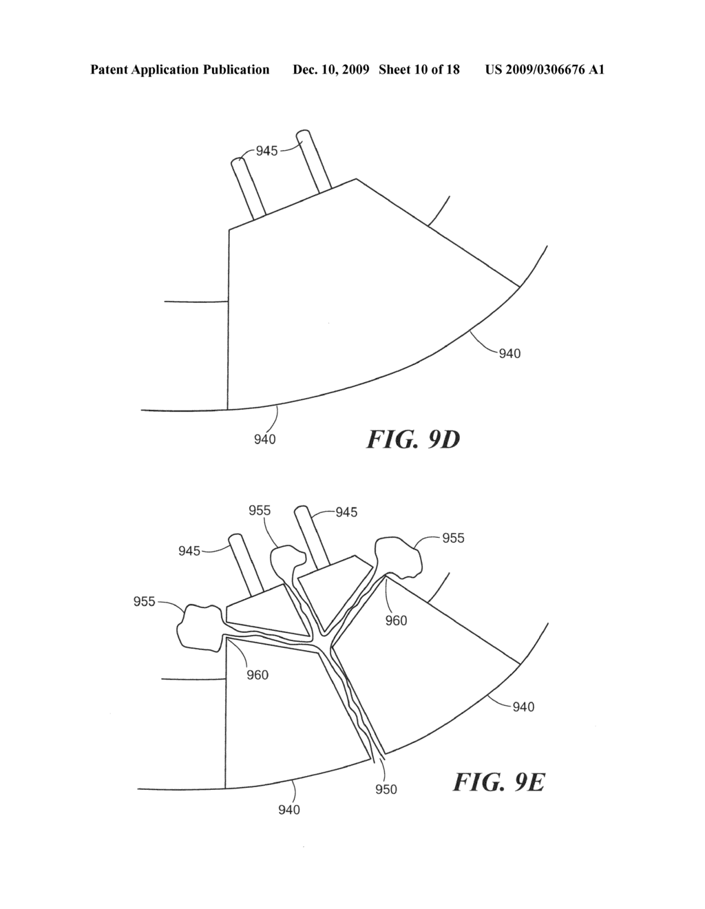 Methods and compositions for articular repair - diagram, schematic, and image 11