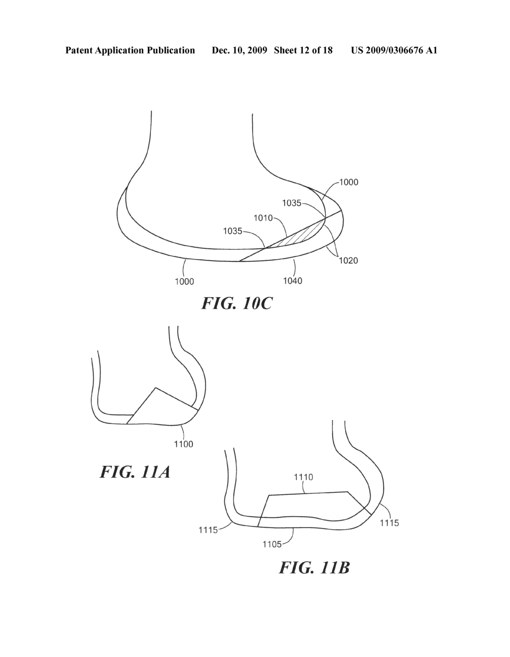 Methods and compositions for articular repair - diagram, schematic, and image 13