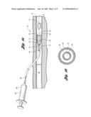 DEVICE FOR RETRIEVING A FOREIGN OBJECT LOCATED IN A BODY VESSEL diagram and image