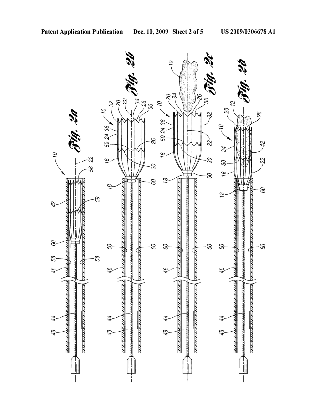 DEVICE FOR RETRIEVING A FOREIGN OBJECT LOCATED IN A BODY VESSEL - diagram, schematic, and image 03