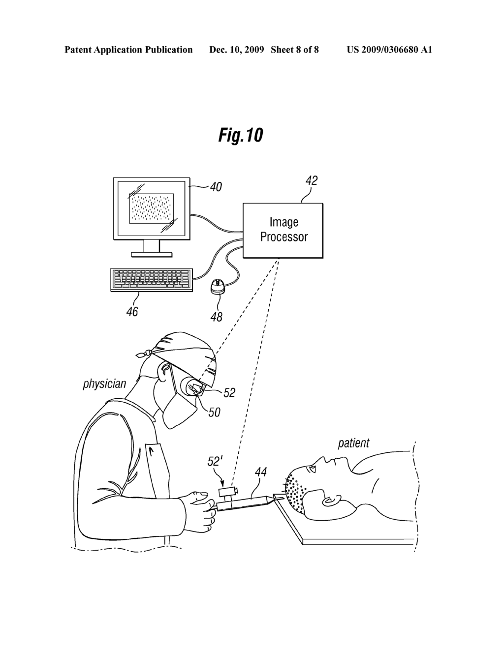 SYSTEM AND METHOD FOR SELECTING FOLLICULAR UNITS FOR HARVESTING - diagram, schematic, and image 09