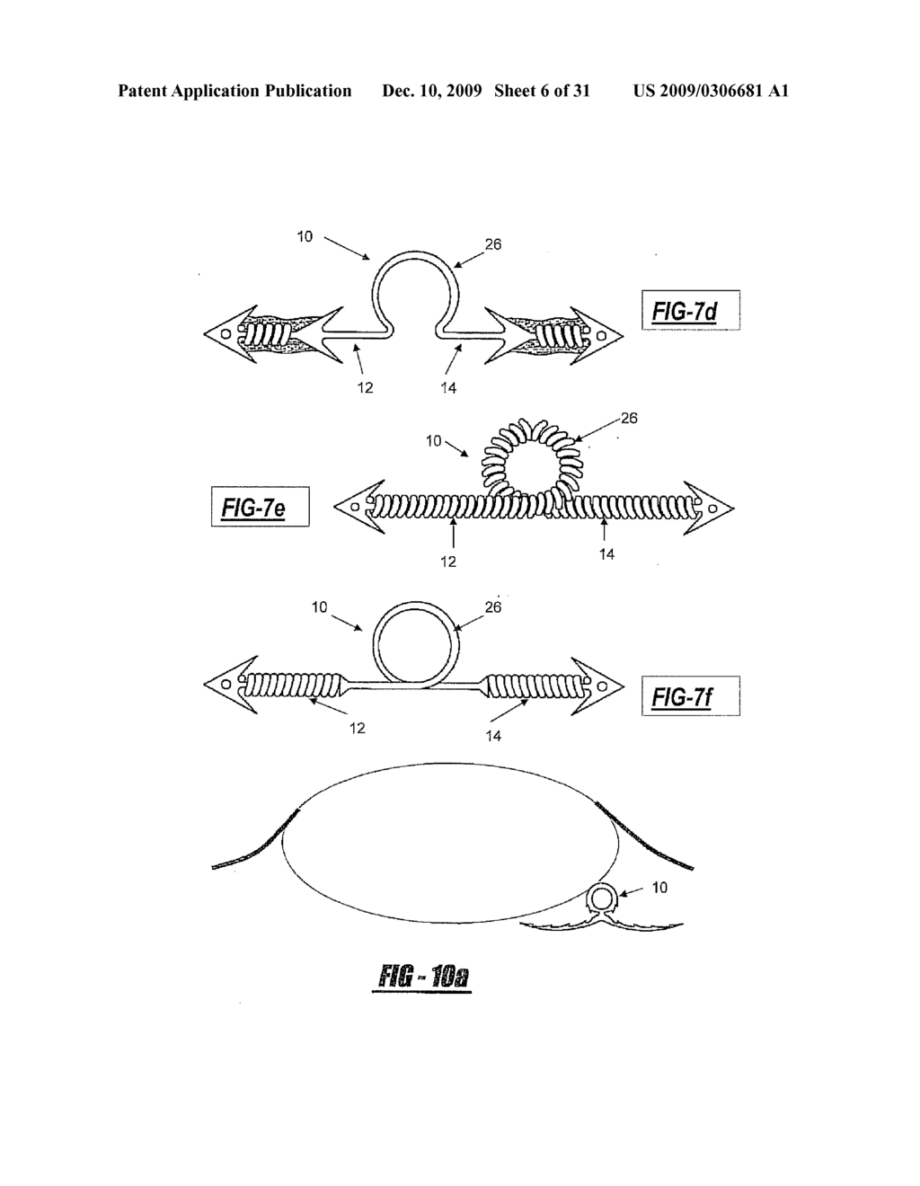 TISSUE TACK - diagram, schematic, and image 07