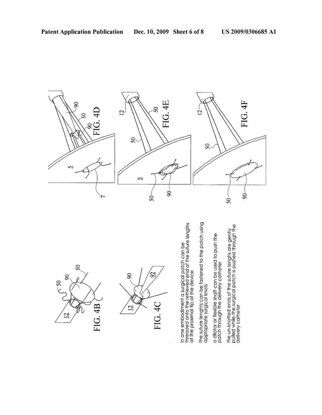 NONINVASIVE TRANS-CATHETER METHOD AND APPARATUS FOR REMOTE SUTURE PLACEMENT SUCH AS FOR SEPTAL DEFECT REPAIR, LEFT ATRIAL APPENDAGE CLOSURE, PACEMAKER ELECTRODE PLACEMENT, MITRAL VALVE REPAIR, AND OTHER INNER-CARDIAC AND INNER-ARTERIAL APPLICATIONS - diagram, schematic, and image 07