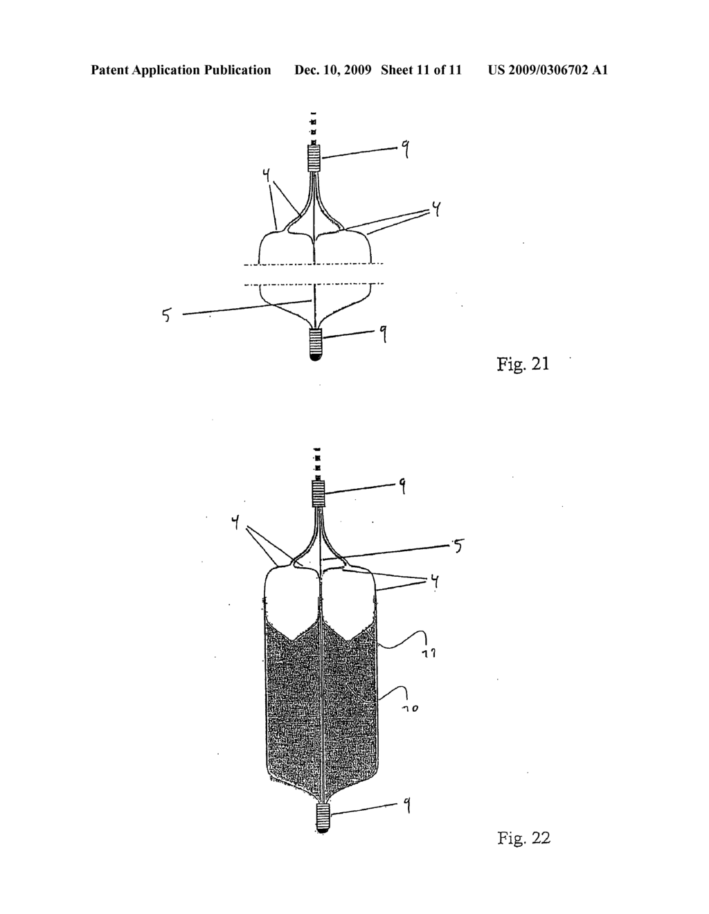 Device for the Removal of Thrombi - diagram, schematic, and image 12