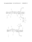 FLUID-POWERED ELONGATION INSTRUMENTATION FOR CORRECTING ORTHOPEDIC DEFORMITIES diagram and image