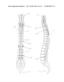 FLUID-POWERED ELONGATION INSTRUMENTATION FOR CORRECTING ORTHOPEDIC DEFORMITIES diagram and image