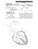 Atrial Capture Verification diagram and image