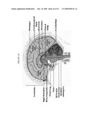 SYSTEMS AND METHODS FOR ALTERING BRAIN AND BODY FUNCTIONS AND FOR TREATING CONDITIONS AND DISEASES OF THE SAME diagram and image