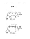 SYSTEMS AND METHODS FOR ALTERING BRAIN AND BODY FUNCTIONS AND FOR TREATING CONDITIONS AND DISEASES OF THE SAME diagram and image