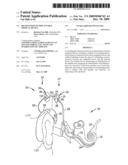 RECOGNITION OF IMPLANTABLE MEDICAL DEVICE diagram and image