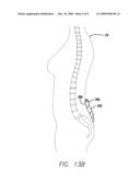 Therapeutic hot and cold water belt diagram and image