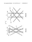 Hybrid Biodegradable/Non-Biodegradable Stent, Delivery System and Method of Treating a Vascular Condition diagram and image