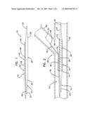 Bifurcation Catheter Assembly With Dynamic Side Branch Lumen diagram and image