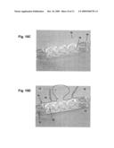 COVERING FOR AN ENDOPROSTHETIC DEVICE AND METHODS OF USING FOR ANEURYSM TREATMENT diagram and image