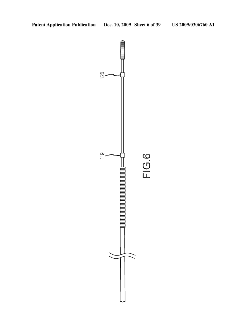 PROSTHESIS AND DELIVERY SYSTEM - diagram, schematic, and image 07