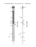 PROSTHESIS AND DELIVERY SYSTEM diagram and image