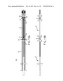 PROSTHESIS AND DELIVERY SYSTEM diagram and image