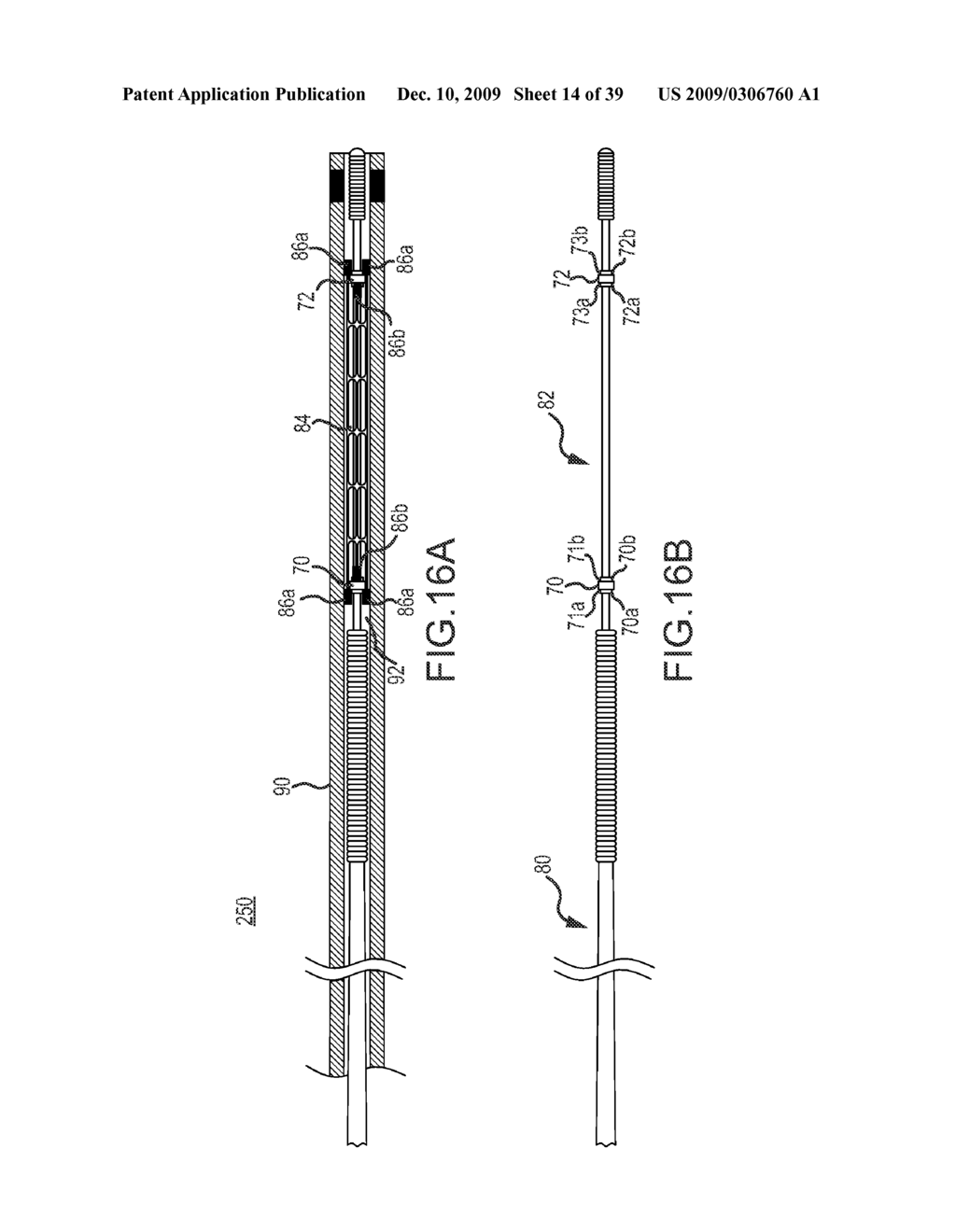 PROSTHESIS AND DELIVERY SYSTEM - diagram, schematic, and image 15