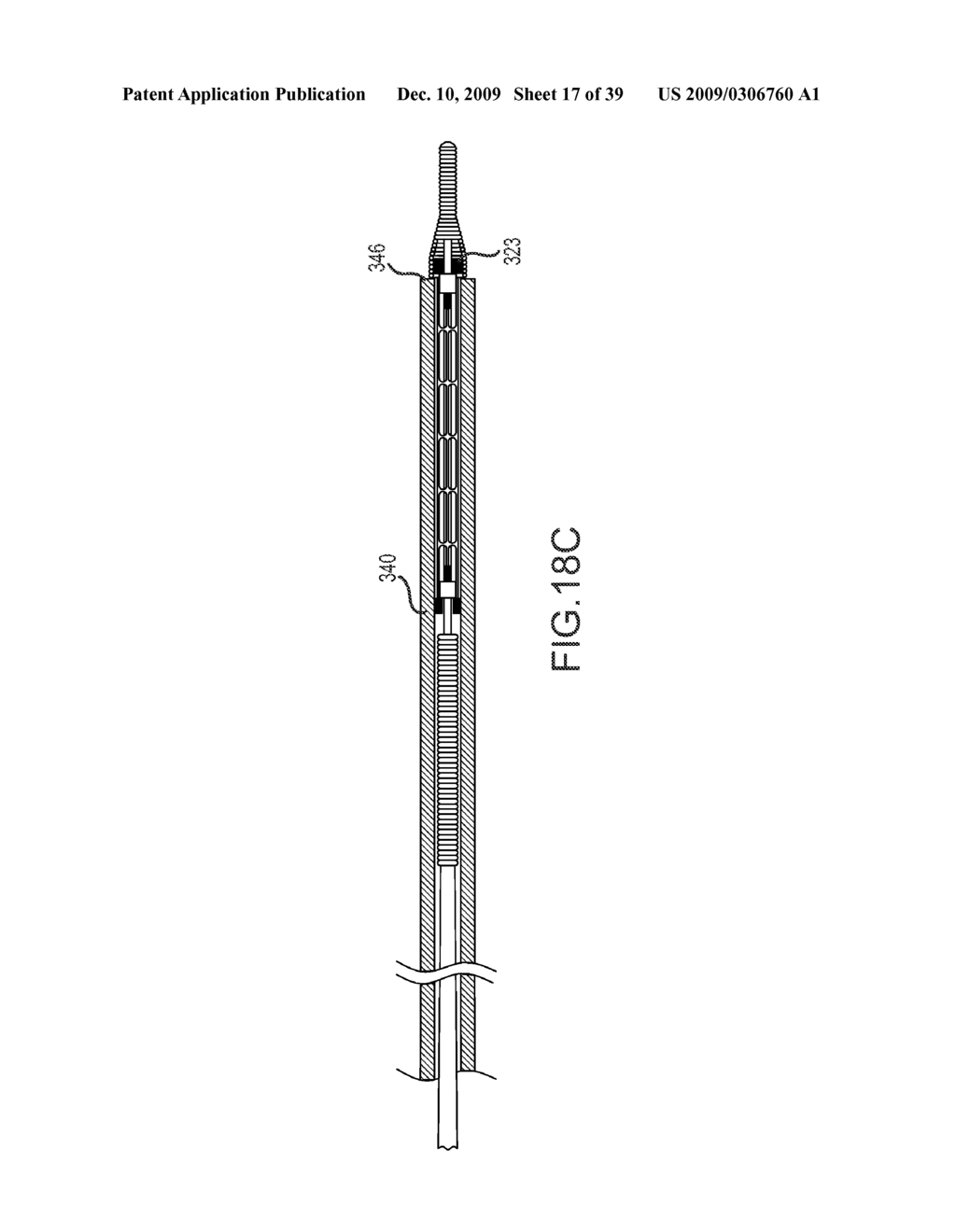 PROSTHESIS AND DELIVERY SYSTEM - diagram, schematic, and image 18