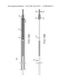 PROSTHESIS AND DELIVERY SYSTEM diagram and image