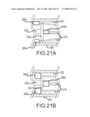 PROSTHESIS AND DELIVERY SYSTEM diagram and image