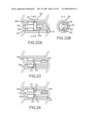 PROSTHESIS AND DELIVERY SYSTEM diagram and image