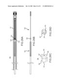 PROSTHESIS AND DELIVERY SYSTEM diagram and image