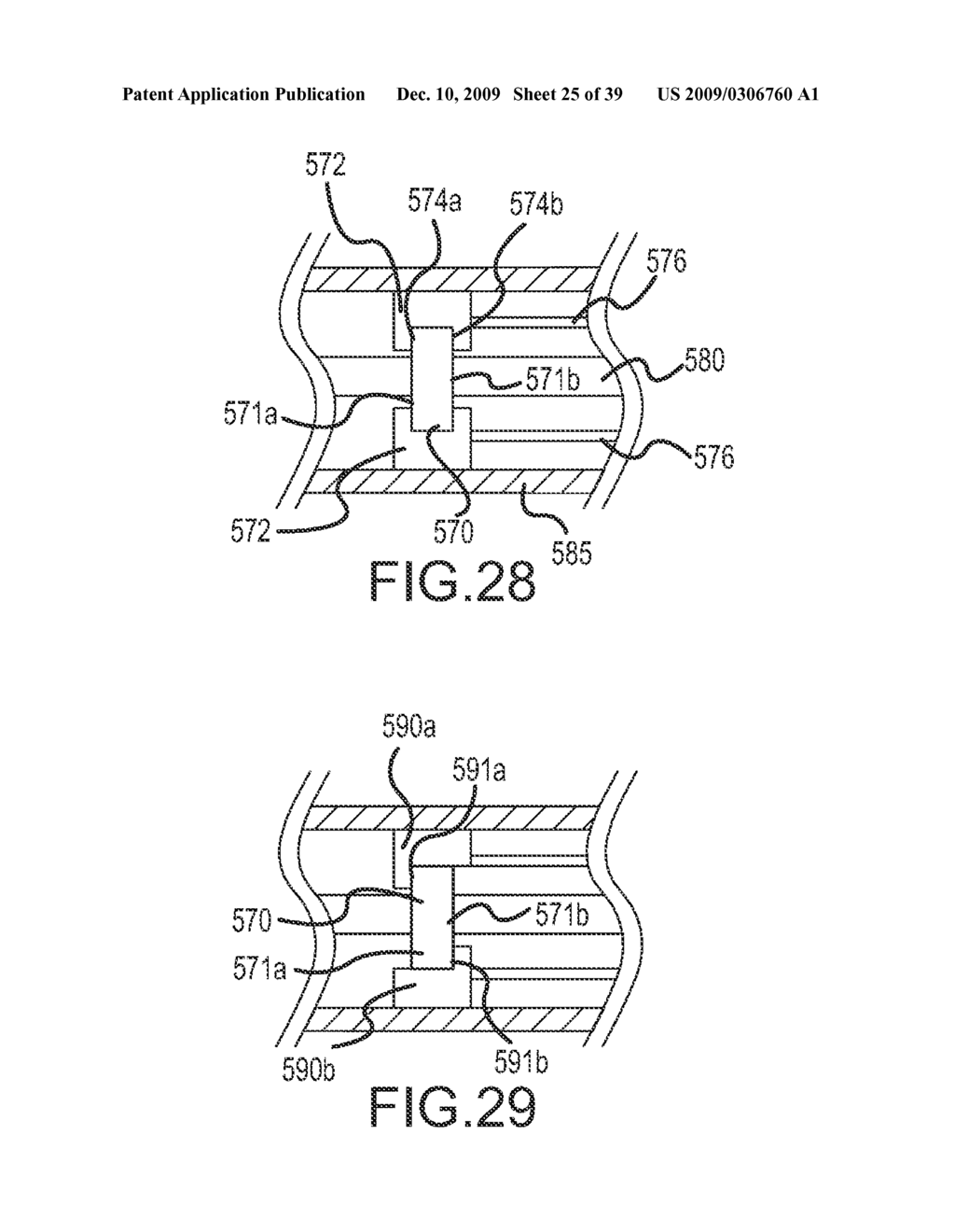 PROSTHESIS AND DELIVERY SYSTEM - diagram, schematic, and image 26