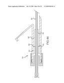 PROSTHESIS AND DELIVERY SYSTEM diagram and image